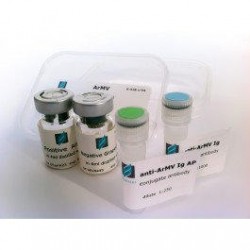 ArMV+GFLV Elisa (Arabis Mosaic Virus + Grapevine FanLeaf Virus)