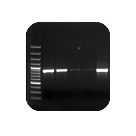 Xanthomonas oryzae PCR   (detection of X.oryzae pv. oryzae and pv. oryzicola with the same primer pair)
