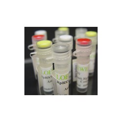 Olive Latent Necrovirus -1. OLV-1